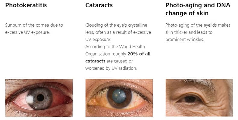 UV Eye Damages and how to protect